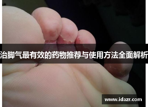 治脚气最有效的药物推荐与使用方法全面解析